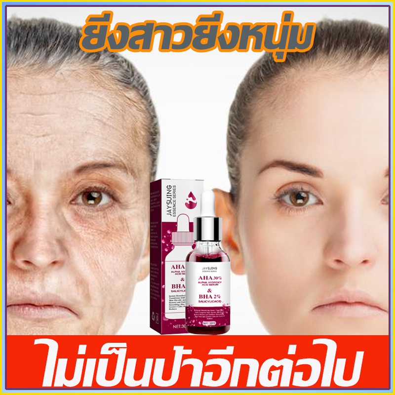 ของแท้-เซรั่มลดเลือนริ้วรอย-ลดริ้วรอยตีนกา-ลดฝ้ากระ-ลดเลือนจุดด่างดำ-เซรั่มเรตินอล-30ml