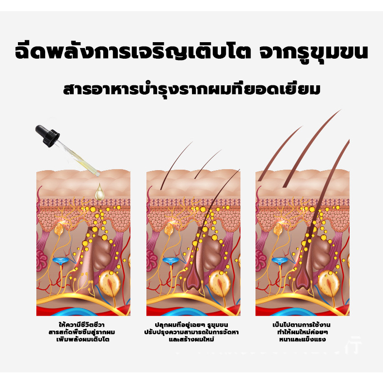 lanemay-เซรั่มปลูกผม-ปลูกผม-บํารุงผม-ป้องกันผมร่วง-ผมบาง-ศีรษะล้าน-30ml-น้ํายาเร่งผมยาว-เซรั่มบํารุงผม-เซรั่มผม