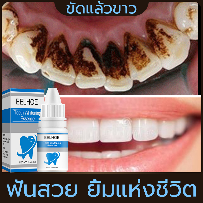 eelhoe-น้ำยาฟอกสีฟัน-10mlสุขอนามัยช่องปาก-ฟันเหลือง-ลดกลิ่นปาก-แปรงฟัน-น้ำยาฟอกสีฟัน-ฟอกฟันขาว-ฟันเหลือง-เซรั่มฟอกฟันขาว