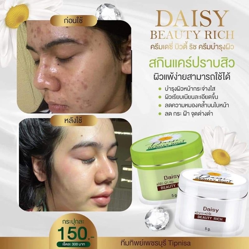 ของแท้-มีของแถม-daisy-beauty-rich-ครีมเดซี่-ครีม-แก้-ฝ้า-สิว-กระ-รอยสิว-หน้าหมอง