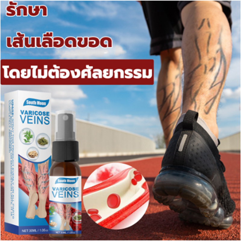 south-moon-สเปรย์เส้นเลือดขอด-30ml-บอกลาเส้นเลือดขอดเส้นเลือดดำอุดตันและอาการป-เส้นเลือดขอด-เส้นเลือดขาบวม