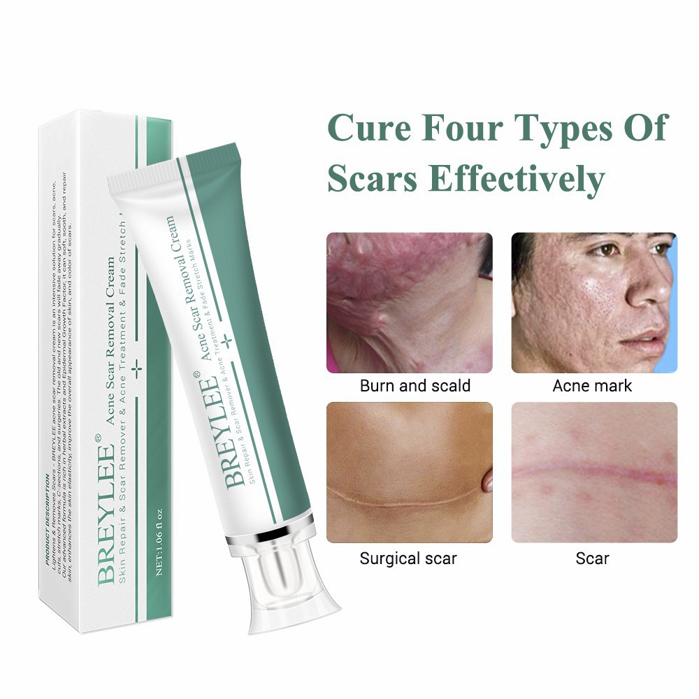 breylee-scar-removal-gel-30g-ครีมลดรอยแผลเป็น-ลดผิวแตกลาย-ลบรอยแผลเป็น-ลดเลือนป้องกันรอยแผลเป็น