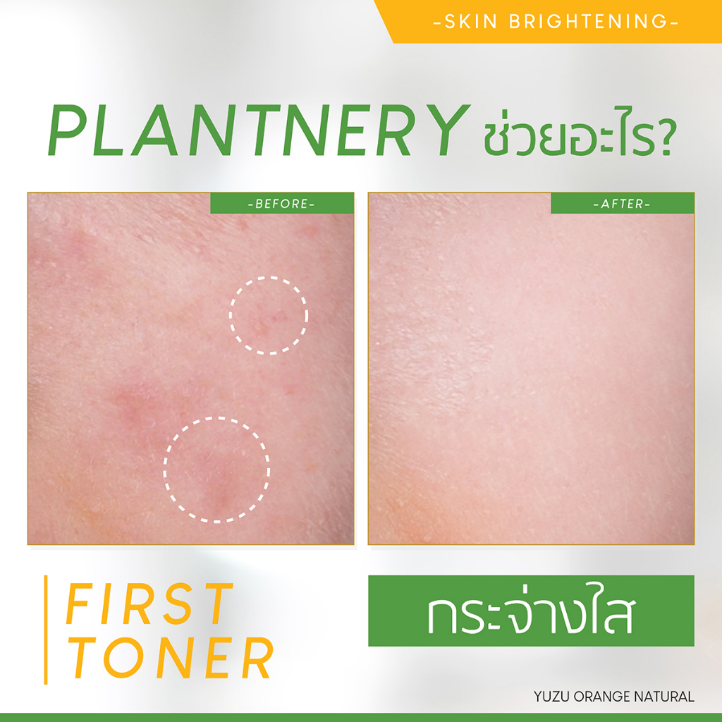 plantnery-yuzu-orange-first-toner-250-ml-โทนเนอร์-ส้มยูซุ-วิตามินซีเข้มข้น-ช่วยผลัดเซลล์ผิว-เผยผิวแลดูกระจ่างใส