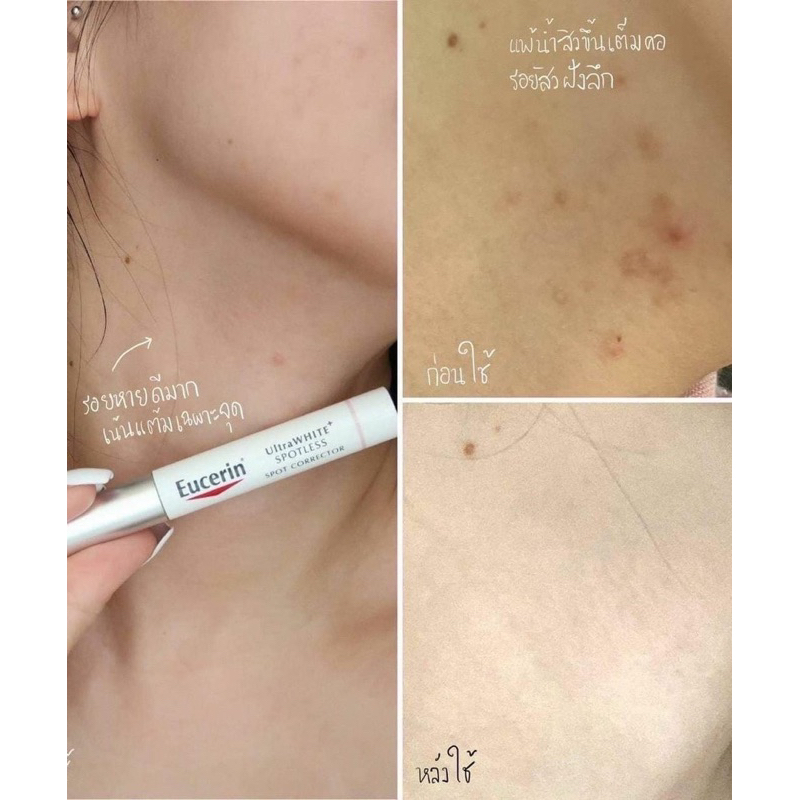 eucerin-ultrawhite-spotless-spot-corrector-5ml