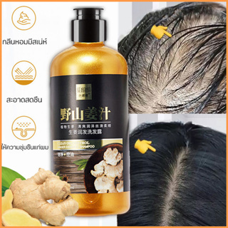 แชมพู แชมพูแก้ผมร่วง สารสกัดจากขิง 300ml ป้องกันผมร่วง ช่วยลดรังแค แชมพู ป้องกันผมร่วงบำรุงผม แชมพูสระผม แชมพูขิง