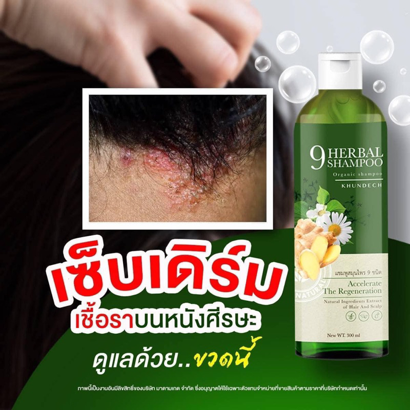 ส่งฟรี-สบู่ว่านรางจืด-สเปรย์-แชมพูขุนเดช-รักษาสิวหลัง-สะเก็ดเงิน-ผิวหนังอักเสบ-ผดผื่นคัน-สังคัง-กลากเกลื้อน-รังแค