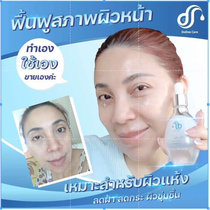 เซรั่ม-ไฮยา-แก้ฝ้า-สลายฝ้า-หน้าใส-แถม-ครีมกันแดดแก้ฝ้า-1-หลอด-สบู่ไฮยา-แก้ฝ้า-1-ก้อน