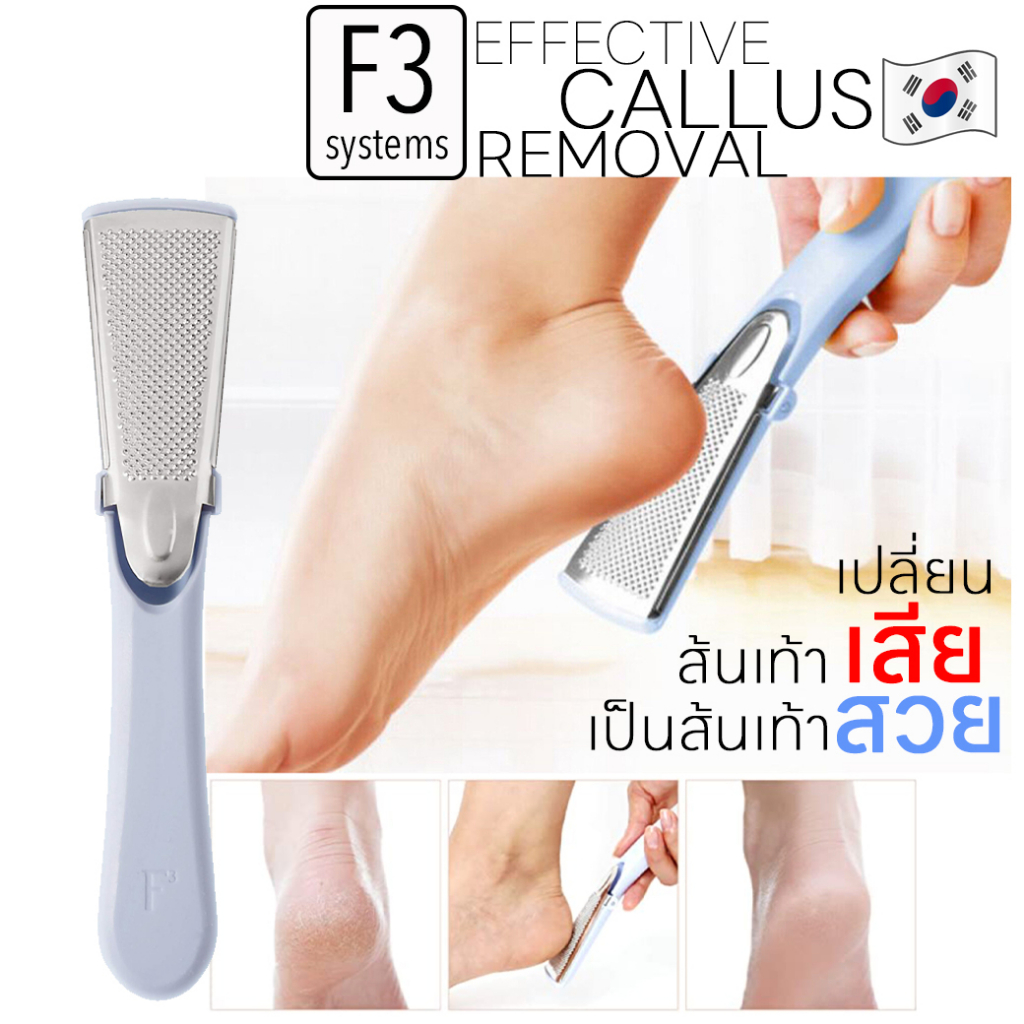 f3-systems-บอกลา-ส้นเท้าแตก-ด้วยที่ขัดส้นเท้า-แก้ผิวหนังบริเวณส้นเท้าที่แห้งและแตกลาย-จากส้นเท้าเสีย-เป็นส้นเท้าสวย