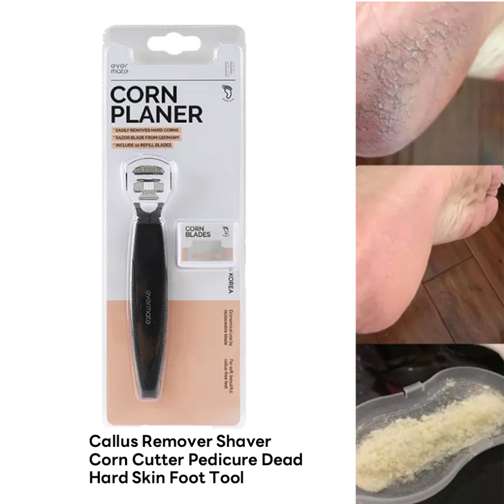 ever-mate-corn-planer-ที่ขูดส้นเท้า-พร้อมใบมีด-กำจัดเซลล์ผิวที่ด้านและตายแล้วออก-ให้ผิวกลับมาสวย-พร้อมบำรุง