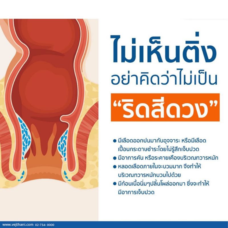 ผลิตภัณฑ์เสริมอาหาร-จากมะขามแขก