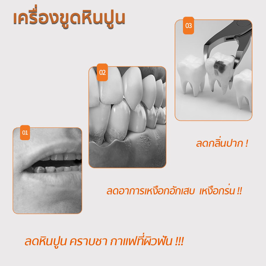 u-smiley-เครื่องทำความสะอาดฟันไฟฟ้าระบบอัลตราโซนิก-เครื่องขูดหินปูน-ขจัดคราบผิวฟัน-ได้ผล100-ปลอดภัย-ไม่เจ็บ