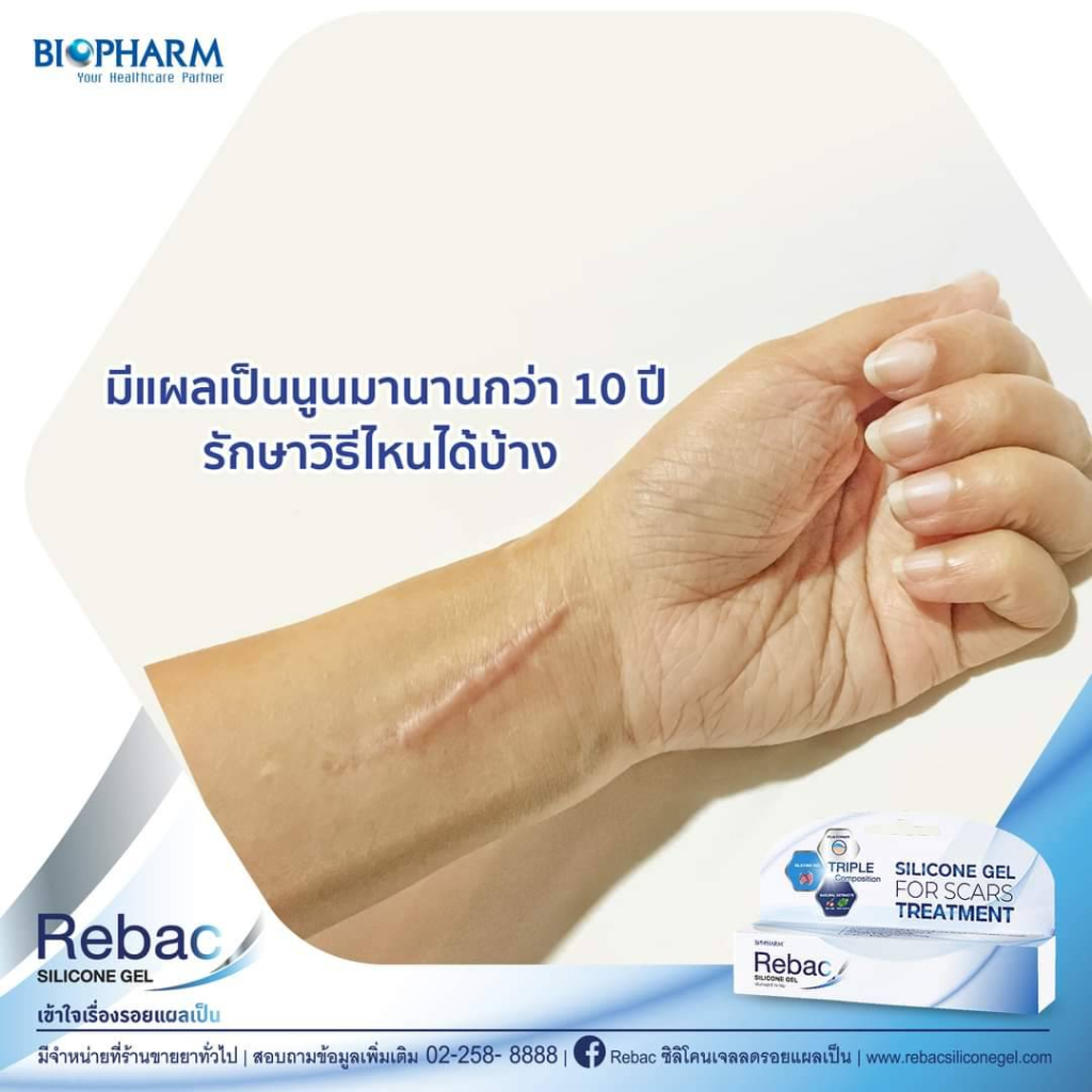 1-หลอด-rebac-silicone-gel-รีแบค-ซิลิโคนเจล-เจลลดรอยแผลเป็น-ขนาด-5-กรัม-สินค้าขายดี-ส่งเร็ว-ถูกที่สุด-by-bns