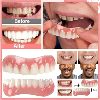 ฟันปลอมแบบครอบ ฟันปลอม ซิลิโคน ฟันปลอมทันตกรรมวีเนียร์ฟัน ฟันปลอมของแท้ จัดฟันขาวจัดฟัน ฟันปลอมแบบสวม ที่ครอบฟันที่กินข้