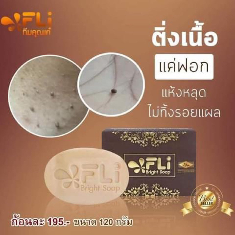 สบู่ผิวสวย-สบู่หน้าใส-สบู่flibrightsoap-ตอกระ-จุดด่างดำ-รอยดำจากสิว-ผิวไม่เรียบเนียน-ติ่งเนื้อเล็กๆ-บนใบหน้าและลำคอ