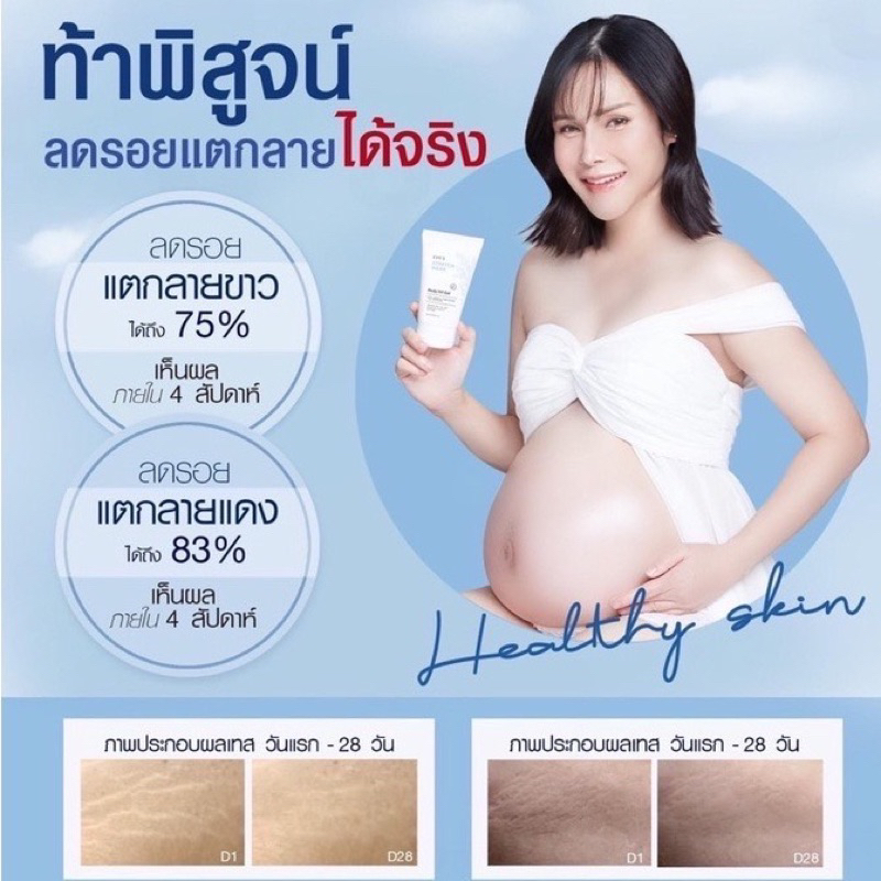 eves-อีฟ-ลดรอยแผลเป็น-stretch-mask-body-oil-gel-ป้องกันผิวแตกลาย-ผิวนุ่ม-ลดจุดด่างดำ-รอยแตกลาย-ครีมคนท้อง-ผิวชุ่มชื้น