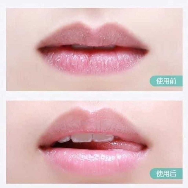 a33-rejuran-calming-lip-balm-3-7g-ลิปบาล์ม-รีจูรัน-สูตรเข้มข้น-ช่วยฟื้นบำรุงริมฝีปากที่แห้ง-แตก-ลอก