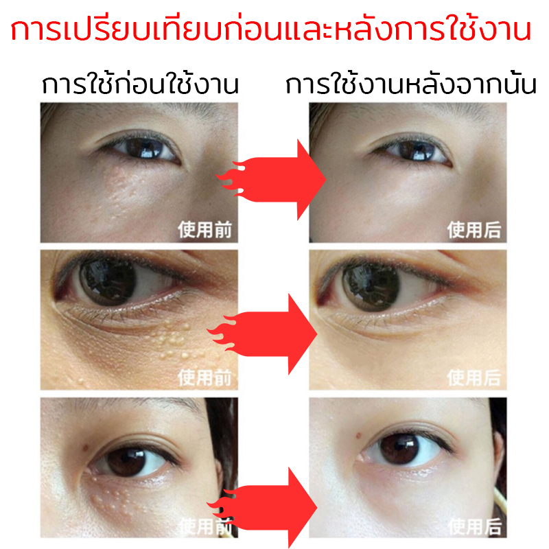 ของแท้-พร้อมส่ง-ครีมบำรุงรอบดวงตา-20g-ดูแลรอบดวงตาและ-ครีมลดถุงใต้ตา-ลดรอยคลำ้ใต้ตาลด-ริ้วรอย