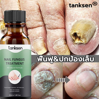 TANKSEN เซรัมบํารุงเล็บ น้ำยาบำรุงเล็บ 30ml ต่อต้านการติตเชื้อรา ซ่อมแซมเล็บแตก เล็บเปราะ เล็บหนา สำหรับมือและเท้า