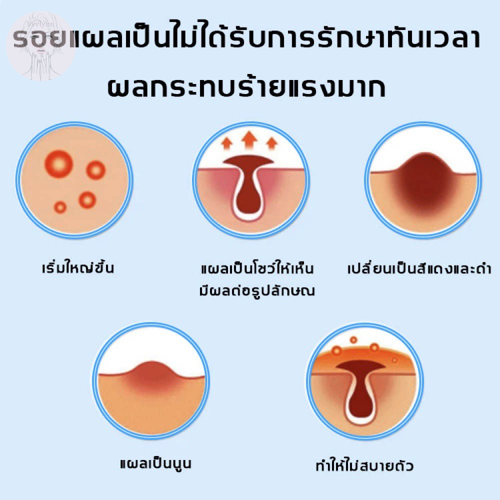 dermatix-ครีมลดรอยแผลเป็น-ครีมทาแผลเป็น15g-รักษารอยแผลเป็น-ทาแผลเป็น-ครีมแผลเป็น