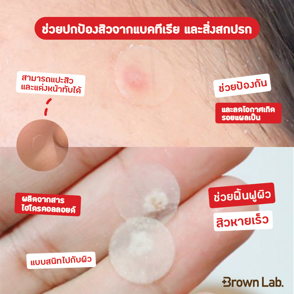 brown-lab-แผ่นแปะรักษาสิว-dr-dreamderm-spot-patch-18-ชิ้น-1-ซอง