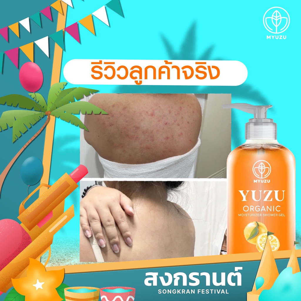 myuzu-organic-ลดสิวที่หลัง-เจลอาบน้ำมิวซุ-organic-มี-biosol-ช่วยฆ่าเชื้อสิว-ลดรอยดำ-ผดผื่น-สิวหลัง-สิวหน้าอก