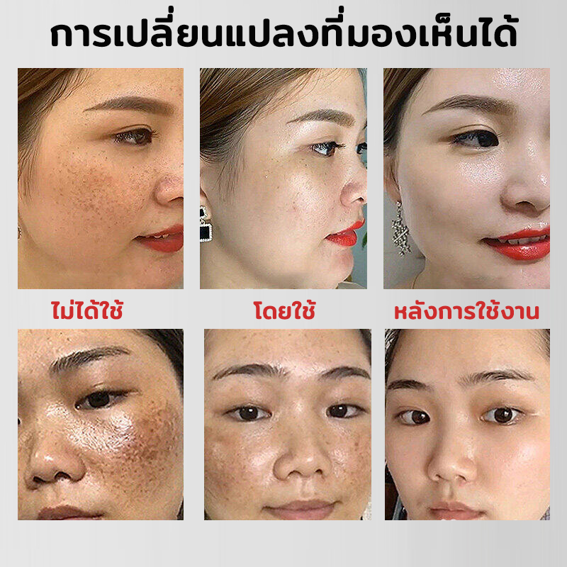 เซรั่มบำรุงผิวหน้า-เซรั่มหน้าขาวใส-35ml-จุดด่างดำจางเร็ว-หน้าขาวใส-ลดริ้วรอย-กระชับรูขุมขน-ครีมทาฝ้ากระ-ครีมแต้ม