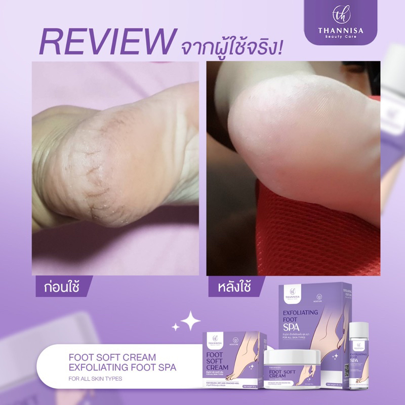 thannisa-spa-foot-1-แถม-1-สปาเท้าธัญนิสา-ส้นเท้าแตก-เท้าเหม็น-เห็นผลตั้งแต่ครั้งแรกที่ใช้