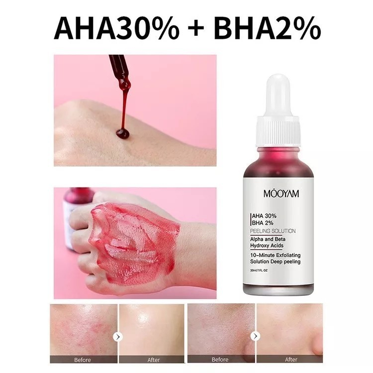 aha-mooyam-aha-30-bha-2-มาส์กแดง-หน้าใส-กําจัดสิว-ควบคุมความมัน-30-ml