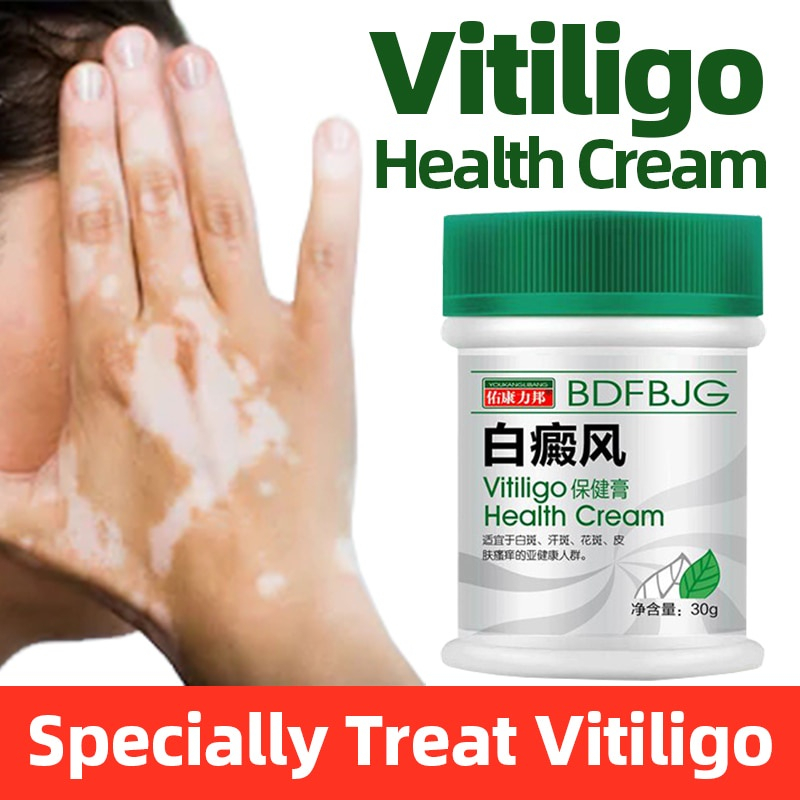 ในสต็อก-โปรโมชั่น-ผิวด่างขาวครีมสมุนไพรจีน-vitiligo-health-creamช่วยได้