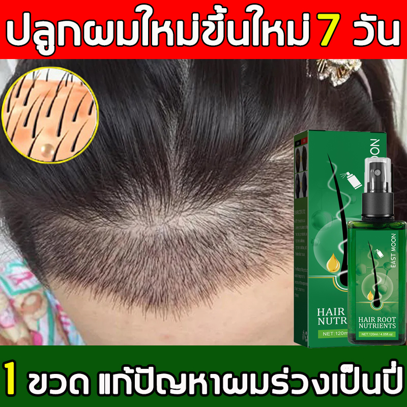 เห็นผลภายใน3วัน-ยาปลูกผมผู้ชาย-120ml-ยาปลูกผม-น้ำยาเร่งผมยาว-เซรั่มปลูกผม-ปลูกผมเร่งด่วน-ปลูกผม-ยาปลูกผมของแท้-สเปรย์ป