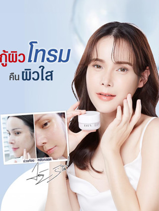 EVES ครีมเจล อีฟส์ ขนาด 20g. ครีมโฟกัส บำรุงหน้า ขาวใส ครีมทาหน้า ครีม ลด รอยสิว ฝ้า กระ จุดด่างดำ สลายฝ้า คนท้องใช้ได้