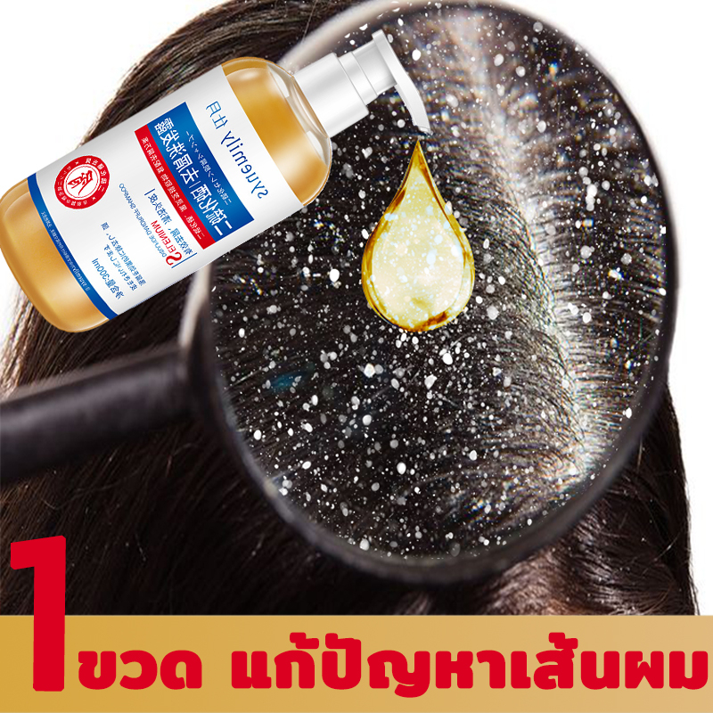 shiyue-แชมพูลดสิว-300ml-รังแค-หนังศีรษะมัน-ขจัดรังแค-กลาดเกลื่อน-เชื้อรา-ช่วยบำรุงเส้นผมและหนังศรีษะ-แชมพูลดอาการคัน