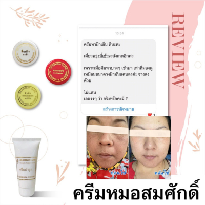 ส่งฟรี-ส่งไว-ครีมฟื้นฟูผิว-คุณหมอสมศักดิ์-หน้าขาว-กระจ่างใส-ลดรอยดำรอยแดงจากสิว-ครีมหน้าใส-ฉ่ำเงา-พร้อมส่ง