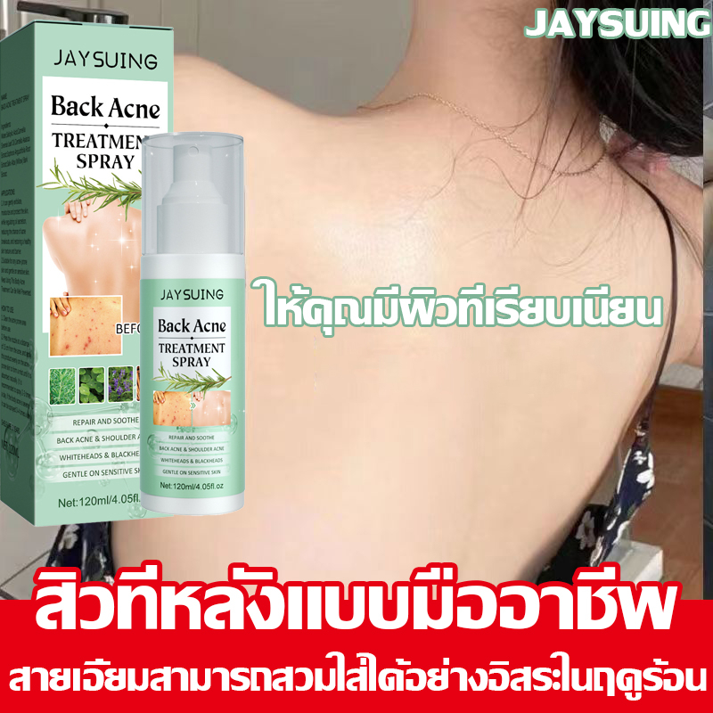 กําจัดสิวได้อย่างรวดเร็วโดยไม่ทิ้งร่องรอย-jaysuing-สเปรย์รักษาสิวที่หลัง-สิวหน้าอก-สิวใบหน้า-สูตรแพทย์แผนไทย