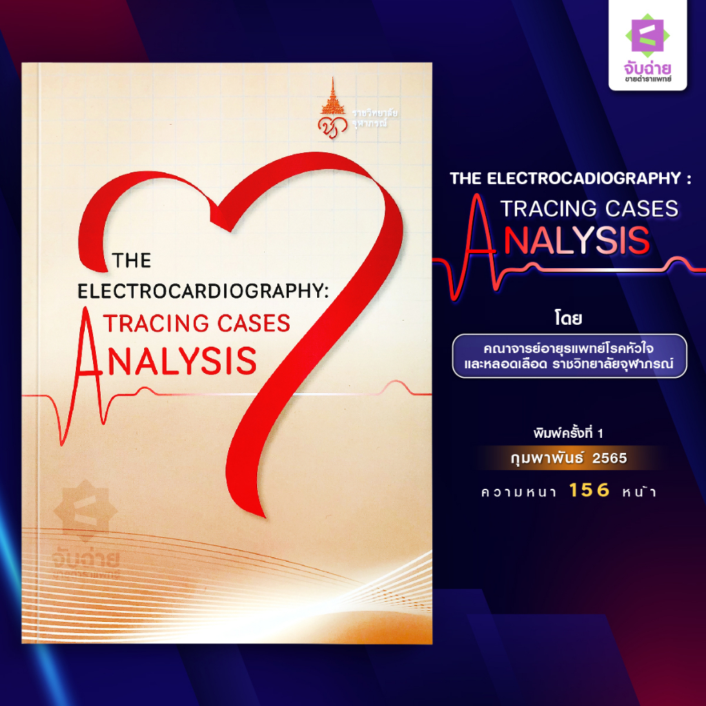 The electrocardiography : Tracing cases analysis | Shopee Thailand