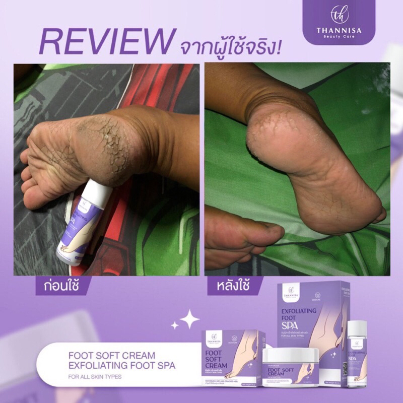 ส่งฟรี-โปร-1-แถม-1-thannisa-spa-foot-สปาเท้าธัญนิสา-ส้นเท้าแตก-เท้าเหม็น-เห็นผลตั้งแต่ครั้งแรกที่ใช้