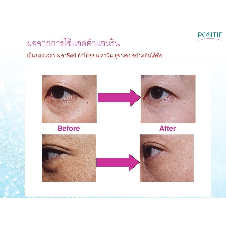 positif-flax-seed-oil-mix-blueberry-extract-lutein-zeaxanthine-โพสิทีฟ-แฟล็กซีด-ขนาดรับประทาน-15-วัน