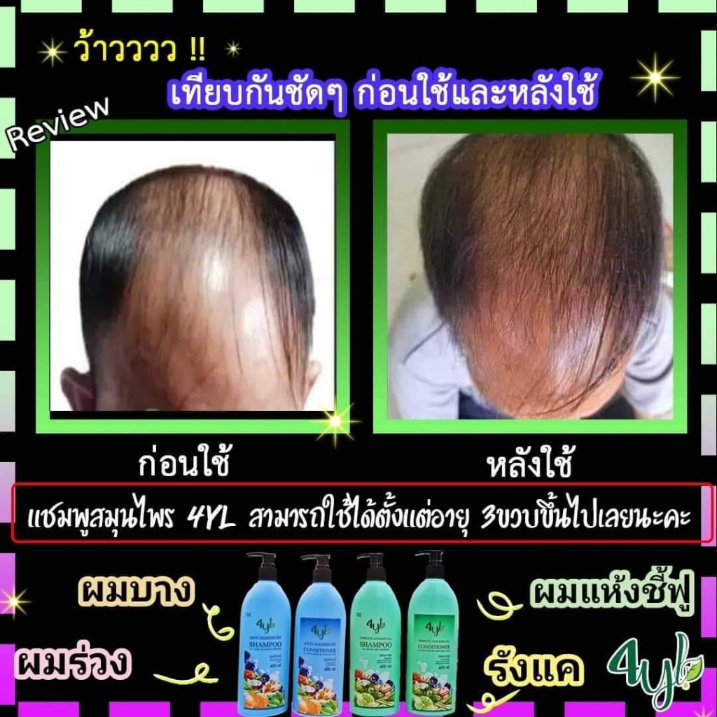 พร้อมส่ง-แชมพูสมุนไพรสุดยอดมหัศจรรย์-4yl-thailand-แชมพูสมุนไพร-จากสารสกัดธรรมชาติ-แท้-100