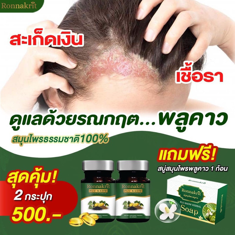 ซื้อ2แถม1-อาหารเสริมแก้สะเก็ดเงิน-ronnakrit-พลูคาว-สกัด