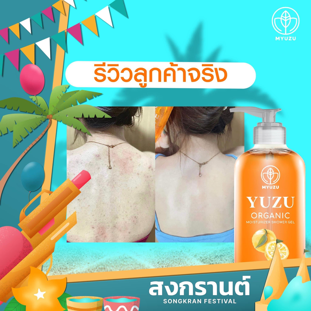 myuzu-organic-ลดสิวที่หลัง-เจลอาบน้ำมิวซุ-organic-มี-biosol-ช่วยฆ่าเชื้อสิว-ลดรอยดำ-ผดผื่น-สิวหลัง-สิวหน้าอก