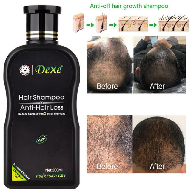 dexe-hair-shampoo-แชมพูบำรุงหนังศรีษะลดการ-ผมขาด-ผมร่วง-ผมบาง