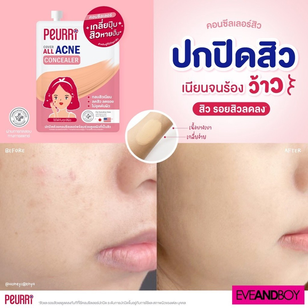 แยก-1-ซอง-peurri-cover-all-acne-concealer-เพียวรี-คัฟเวอร์-ออล-แอคเน่-คอนซีลเลอร์-3-กรัม