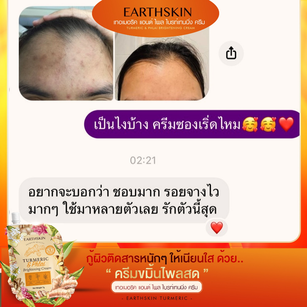 ครีมขมิ้นไพรสด-หน้าใส-ลดสิว-รอยดำรอยแดง-ฝ้า-กระ-จุดด่างดำ