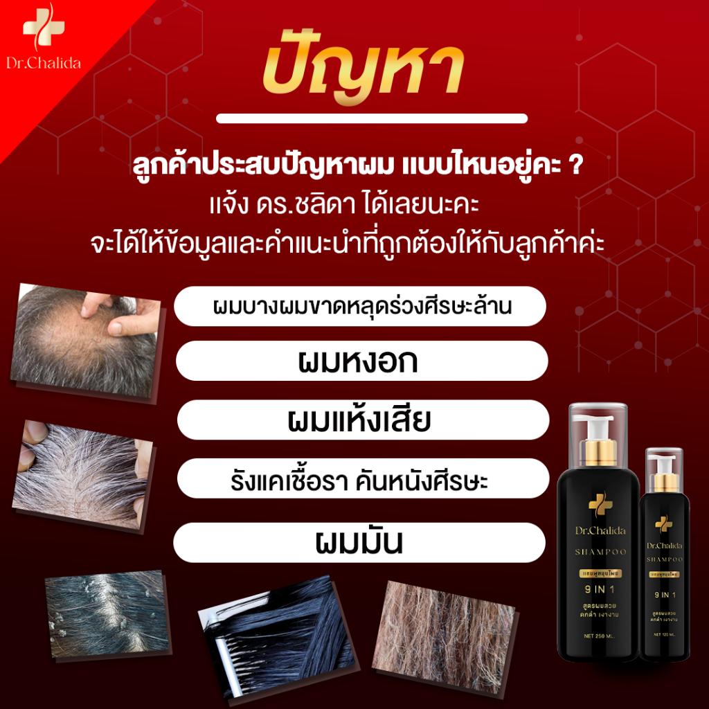 ส่งฟรี-dr-chalida-แชมพูสมุนไพร-ลดปัญหาผมหลุดร่วง-ลดหงอก-เพิ่มผม-ลดรังแค-ไม่ผสมสารเคมี-รักษาถึงรากผม-2-แถม-1