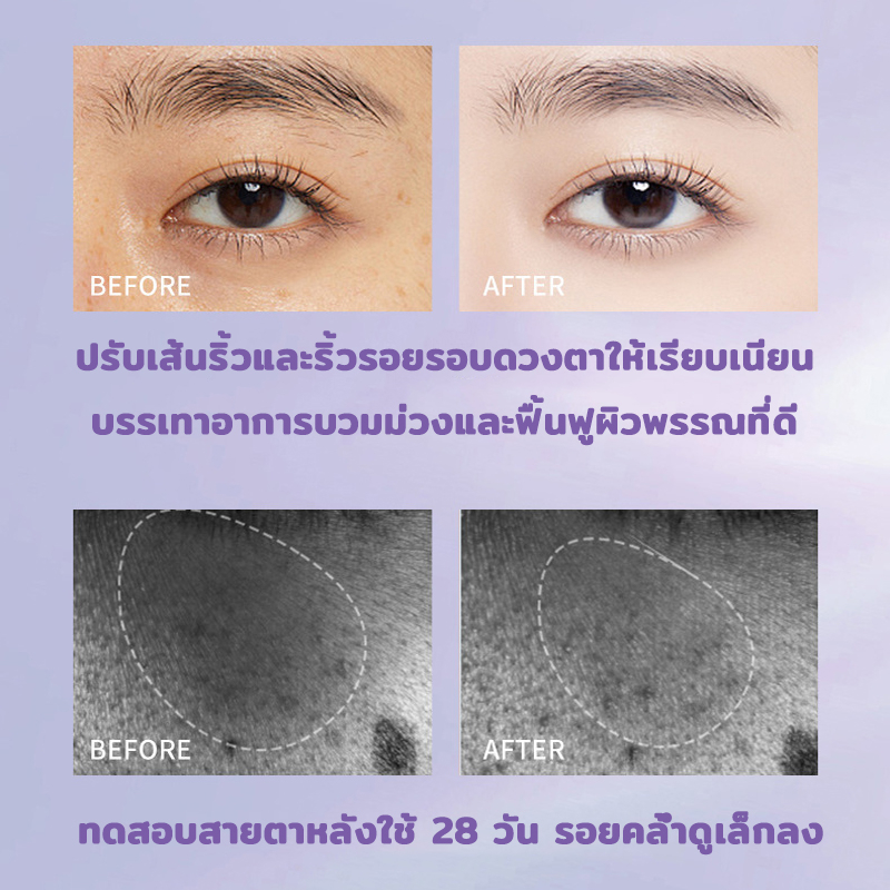 ของแท้-พร้อมส่ง-ginbi-อายครีมบำรุงตา-30g-ลบคล้ำบวมใต้ตา-กระชับรอยตีนกา-ลดเม็ดไขมัน-ฟื้นฟูผิวตา-ครีมทาใต้ตาดำ-อายครีม