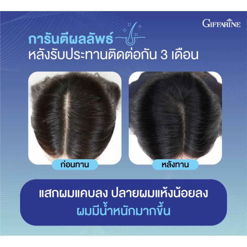 ไบโอติน-h-plus-อาหารเสริมบำรุงผม