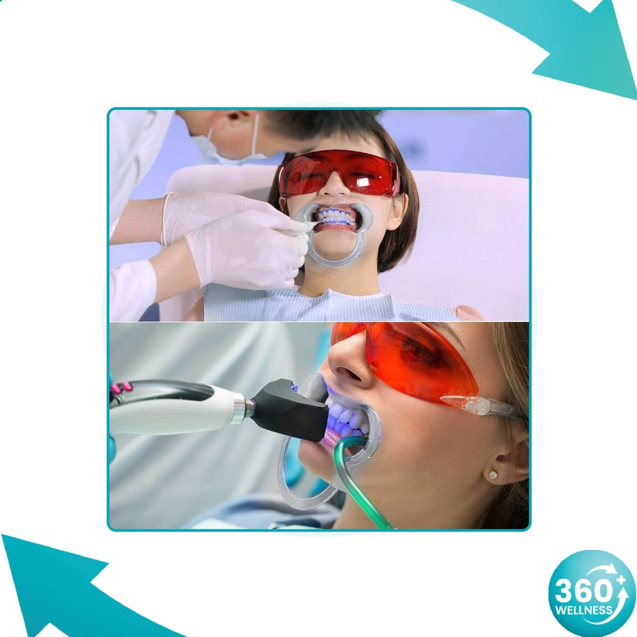 360wellness-ศูนย์รวมอุปกรณ์-เพื่อสุขภาพ-ที่อ้าปาก-ที่ถ่างปาก-ที่ง้างปาก-ที่ครอบปาก-ฟรีไซซ์