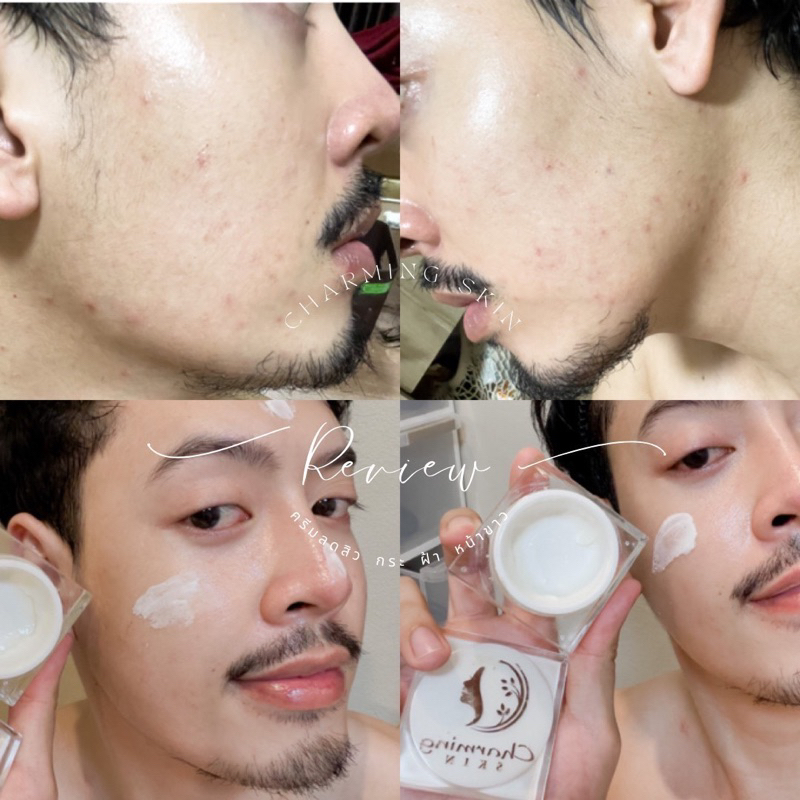 ชามมิ่งสกิน-charmingskin-ครีมลดฝ้า-ของแท้แบรนด์ไทย-มีอย-เช็คได้ค่ะ-แพ็คเก็จใหม่นะค่ะ