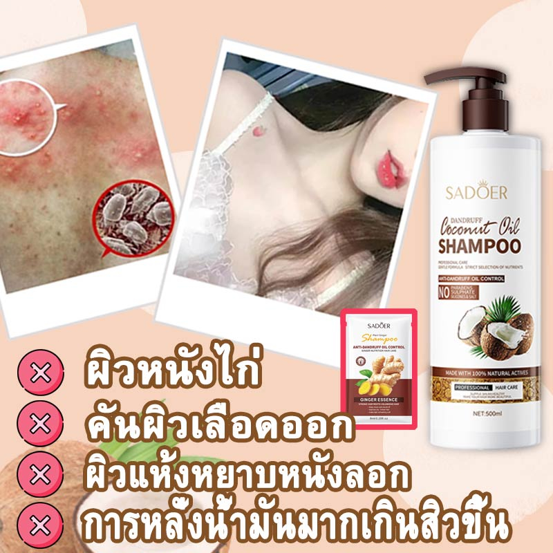 ลดสิวที่หลัง-สบู่ผิวขาว-ครีมอาบน้ําผิวขาว-ครีมอาบน้ำหอมๆ-ครีมอาบน้ำ-ช่วยฆ่าเชื้อสิว-ลดรอยดำ-ผดผื่น-สิวหลัง-สิวหน้าอก