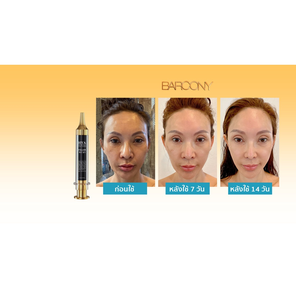 laser-serum-ขาวใส-ไร้ฝ้า-กระ-เกาหลี